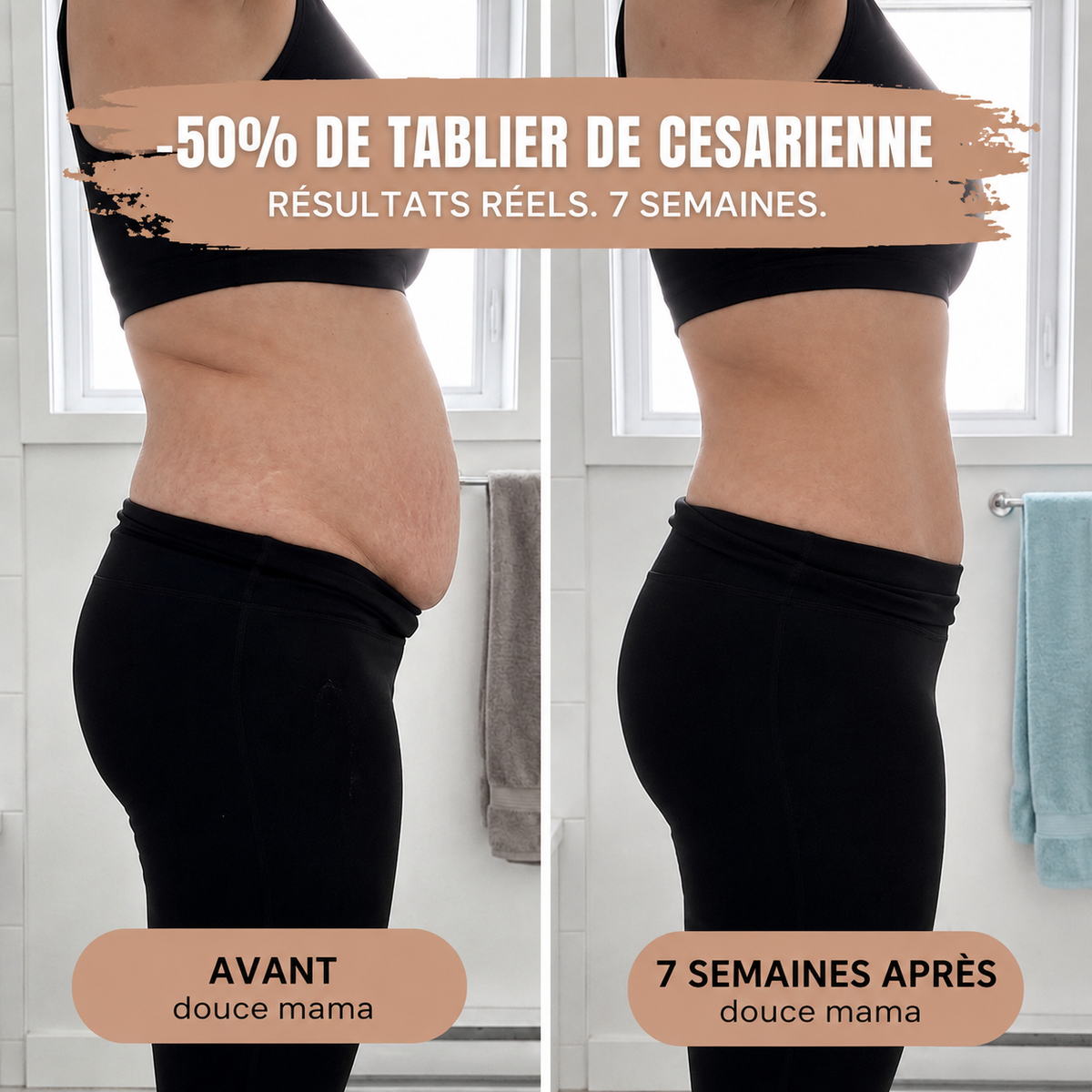 Culotte Post-Partum — Compression 360°